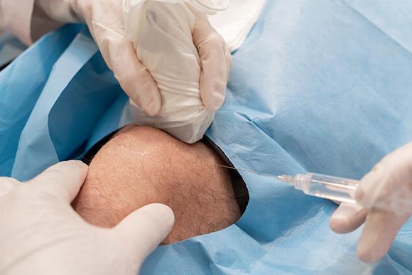 Ultrasound guided knee injection with medical sheet